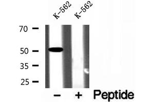 Western blot analysis of extracts of K-562 cells, using ZnT6 antibody. (SLC30A6 Antikörper  (Internal Region))