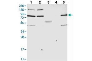Western blot analysis of Lane 1: RT-4, Lane 2: U-251 MG, Lane 3: Human Plasma, Lane 4: Liver, Lane 5: Tonsil with SMCR8 polyclonal antibody  at 1:250-1:500 dilution.