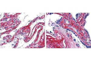 anti collagen V antibody (600-401-107 Lot 22063, 1:200, 45 min RT) showed strong staining in FFPE sections of human lung (left) with strong staining within alveoli, vessels, and in connective tissue spaces; and placenta (right) with strong staining observed in stromal and connective tissue spaces and vessel walls. (Collagen Type V Antikörper)