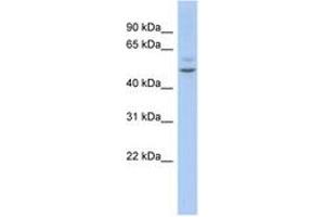 Image no. 1 for anti-Myocyte Enhancer Factor 2C (MEF2C) (AA 359-408) antibody (ABIN6744402) (MEF2C Antikörper  (AA 359-408))