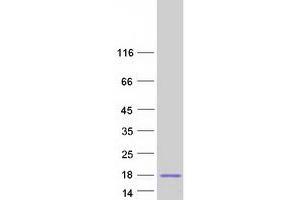 Validation with Western Blot (SPACA3 Protein (Myc-DYKDDDDK Tag))