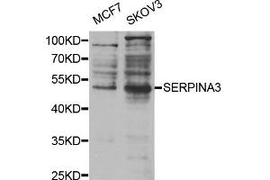 Western Blotting (WB) image for anti-serpin Peptidase Inhibitor, Clade A (Alpha-1 Antiproteinase, Antitrypsin), Member 3 (SERPINA3) antibody (ABIN1875398) (SERPINA3 Antikörper)