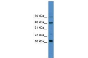 Image no. 1 for anti-Caspase 3 (CASP3) (AA 80-129) antibody (ABIN6745427) (Caspase 3 Antikörper  (AA 80-129))