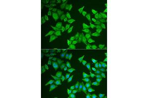 Immunofluorescence analysis of HeLa cell using ALAS2 antibody.