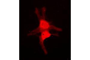 Immunofluorescence (IF) image for anti-Mitogen-Activated Protein Kinase 10 (MAPK10) (C-Term) antibody (ABIN7296712)