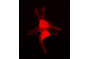 Immunofluorescent analysis of JNK3 staining in NIH3T3 cells. (MAPK10 Antikörper  (C-Term))