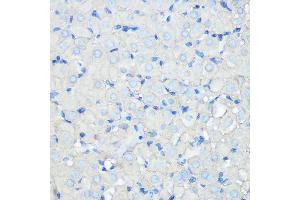 Immunohistochemistry of paraffin-embedded rat ovary using SR-BI Rabbit mAb (ABIN7270156) at dilution of 1:100 (40x lens). (SCARB1 Antikörper)