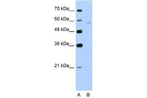 WB Suggested Anti-SLC22A7  Antibody Titration: 5. (SLC22A7 Antikörper  (N-Term))