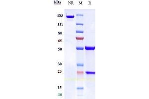 Anti-TFPI Reference Antibody (concizumab) on SDS-PAGE under reducing (R) condition. (Rekombinanter TFPI (Concizumab Biosimilar) Antikörper)