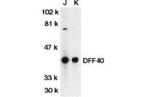 Image no. 1 for anti-DNA Fragmentation Factor, 40kDa, beta Polypeptide (Caspase-Activated DNase) (DFFB) (AA 3-18) antibody (ABIN203319) (DFFB Antikörper  (AA 3-18))
