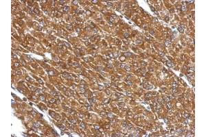 Immunohistochemistry (IHC) image for anti-Cytochrome P450, Family 27, Subfamily A, Polypeptide 1 (CYP27A1) (Center) antibody (ABIN2855688)