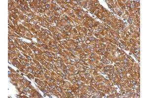 IHC-P Image Immunohistochemical analysis of paraffin-embedded U87 xenograft, using CYP27A1, antibody at 1:500 dilution. (CYP27A1 Antikörper  (Center))