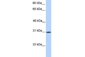 WB Suggested Anti-SIGLEC12 Antibody Titration:  0. (SIGLEC12 Antikörper  (N-Term))