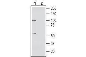 Western blot analysis of human  neuroblastoma cell line lysate:1. (Solute Carrier Family 30, Member 10 (SLC30A10) Peptid)