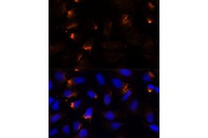 Immunofluorescence (IF) image for anti-Matrix Metallopeptidase 3 (Stromelysin 1, Progelatinase) (MMP3) (AA 248-477) antibody (ABIN3021709)