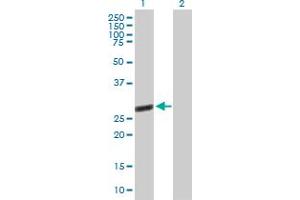 Western Blot analysis of TTC9B expression in transfected 293T cell line by TTC9B MaxPab polyclonal antibody. (TTC9B Antikörper  (AA 1-239))