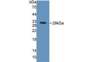 Western blot analysis of recombinant Rat MYH6. (MYH6 Antikörper  (AA 419-666))