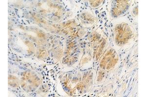ABIN6259523 and ABIN6273970 at 1/100 staining human normal gastric tissue by IHC-P.