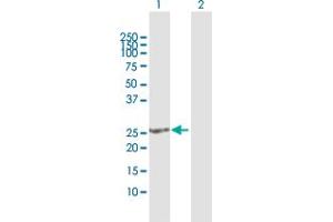 Western Blot analysis of SOHLH2 expression in transfected 293T cell line by SOHLH2 MaxPab polyclonal antibody. (SOHLH2 Antikörper  (AA 1-225))