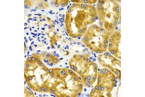 Immunohistochemistry of paraffin-embedded Human kidney using CDK20 antibody at dilution of 1:100 (x400 lens). (CCRK Antikörper)
