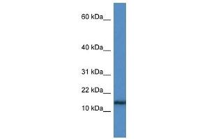 Western Blot showing HIST1H3A antibody used at a concentration of 1 ug/ml against Jurkat Cell Lysate (HIST1H3A Antikörper  (N-Term))