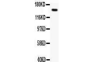 Observed bind size: 154KD (c-MET Antikörper  (AA 208-407))