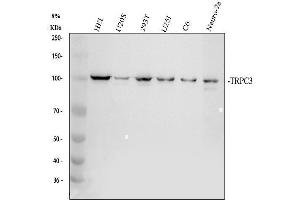 Western blot analysis of TRPC3 using anti-TRPC3 antibody (ABIN5518886).