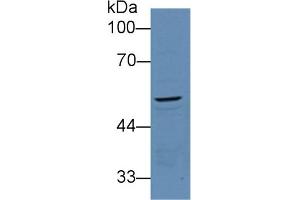 Detection of PCOLCE in Mouse Kidney lysate using Polyclonal Antibody to Procollagen C-Endopeptidase Enhancer (PCOLCE) (PCOLCE Antikörper  (AA 36-468))