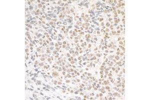 Immunohistochemistry (IHC) image for anti-Structural Maintenance of Chromosomes 1A (SMC1A) (C-Term) antibody (ABIN7453928)