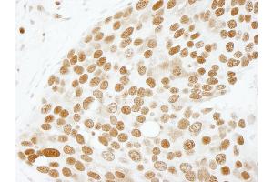 Immunohistochemistry (IHC) image for anti-Activated RNA Polymerase II Transcriptional Coactivator p15 (SUB1) (AA 77-127) antibody (ABIN7448719)