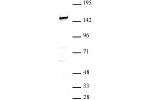 SMARCC1 / BAF155 antibody (pAb) tested by Western blot. (SMARCC1 Antikörper  (N-Term))
