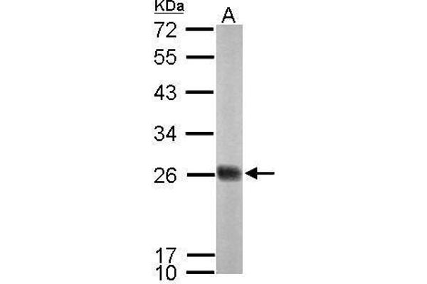NDUFS8 Antikörper  (Center)