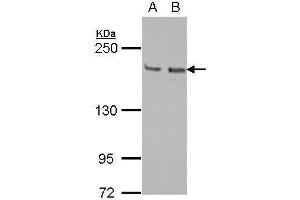 WB Image Sample (30 ug of whole cell lysate) A: Jurkat B: Raji 5% SDS PAGE antibody diluted at 1:1000 (KIF14 Antikörper  (N-Term))