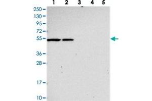 Western blot analysis of Lane 1: RT-4, Lane 2: U-251 MG, Lane 3: Human Plasma, Lane 4: Liver, Lane 5: Tonsil with SLC24A6 polyclonal antibody . (SLC24A6 Antikörper)
