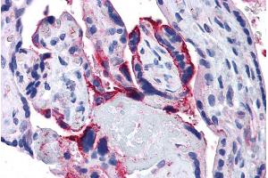 ABIN190762 (5µg/ml) staining of paraffin embedded Human Placenta. (APH1A Antikörper  (Internal Region))