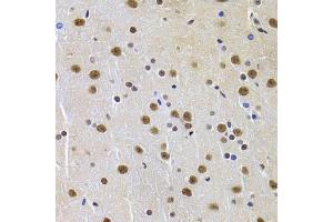 Immunohistochemistry of paraffin-embedded rat brain using PPP1R8 Antibody (ABIN5974046) at dilution of 1/100 (40x lens). (PPP1R8 Antikörper)