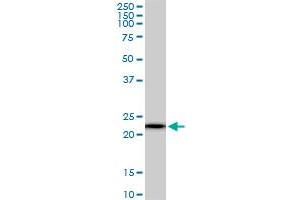 RPS5 monoclonal antibody (M01), clone 3G3. (RPS5 Antikörper  (AA 106-204))