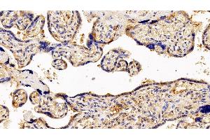 Detection of GCSFR in Human Placenta Tissue using Polyclonal Antibody to Colony Stimulating Factor Receptor, Granulocyte (GCSFR) (CSF3R Antikörper  (AA 26-138))