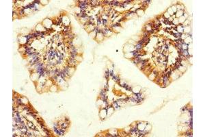 Immunohistochemistry of paraffin-embedded human small intestine tissue using ABIN7170368 at dilution of 1:100 (SNX18 Antikörper  (AA 449-628))