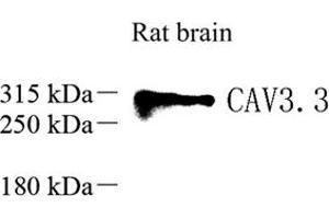 Western blot analysis of Ca(v)3. (CACNA1I Antikörper)