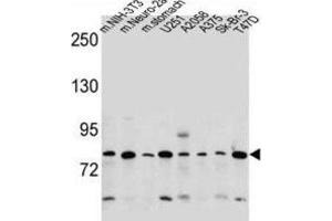 Western Blotting (WB) image for anti-Discoidin, CUB and LCCL Domain Containing 2 (DCBLD2) antibody (ABIN2997563)