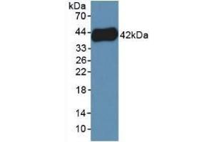Detection of Recombinant PF4V1, Human using Polyclonal Antibody to Platelet Factor 4 Variant 1 (PF4V1) (PF4V1 Antikörper  (AA 1-104))