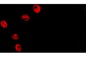 ABIN6278580 staining HepG2 by IF/ICC. (HIST1H2BH Antikörper  (N-Term))