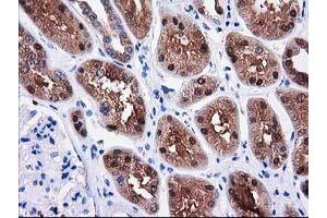 Immunohistochemical staining of paraffin-embedded Human Kidney tissue using anti-SULT1C2 mouse monoclonal antibody. (SULT1C2 Antikörper)