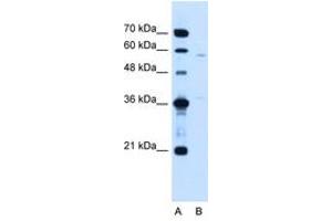 Image no. 1 for anti-Coiled-Coil Domain Containing 112 (CCDC112) (AA 71-120) antibody (ABIN205068) (CCDC112 Antikörper  (AA 71-120))