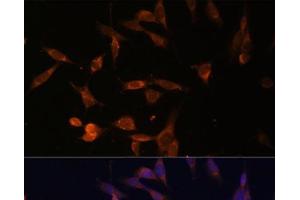 Immunofluorescence analysis of NIH-3T3 cells using UMPS Polyclonal Antibody at dilution of 1:100 (40x lens). (UMPS Antikörper)