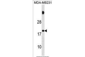 SPNXB Antibody (Center) (ABIN1881824 and ABIN2839075) western blot analysis in MDA-M cell line lysates (35 μg/lane). (SPANXB1 Antikörper  (AA 17-47))