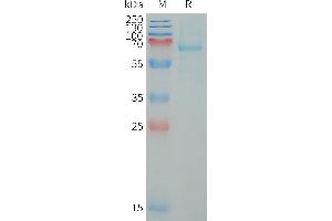 SDS-PAGE (SDS) image for Leukocyte Immunoglobulin-Like Receptor, Subfamily B (With TM and ITIM Domains), Member 5 (LILRB5) (AA 24-458) protein (His tag) (ABIN7538356)