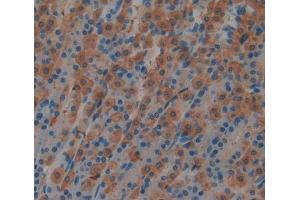 Used in DAB staining on fromalin fixed paraffin- embedded stomach tissue (MATK Antikörper  (AA 1-173))