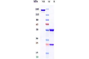 Anti-CD79b Reference Antibody (polatuzumab) on SDS-PAGE under reducing (R) condition. (Rekombinanter CD79B (Polatuzumab Biosimilar) Antikörper)